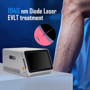 Varicose Veins Laser 1940