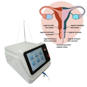 980nm 1470 Diode Laser for Gynecology f