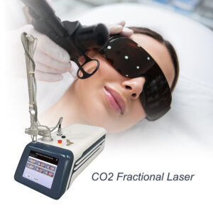 Co2 Fractional Laser Machine Stretch Marks