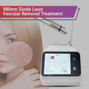 Spider Vein Blood Vessels Removal