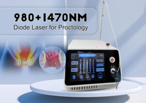 Proctology Diode Laser Hemorrhoids