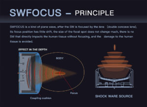 Focus Shock Waves Therapy Machine