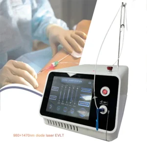 Evlt laser fibres Healthcare endovenous laser thermal ablation(EVLA) 1470nm varicose vein laser