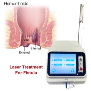 Fiber Laser Therapy Hemorrhoid Remover 980nm 1470nm Diode Laser for Proctology Hemorrhoidectomy Surgery Device