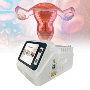 Treatment Of Vaginal Atrophy Or Urinary Incontinence Vaginal Loose Syndrome (VRS) 980nm 1470nm Cosmetic Gynecology Laser