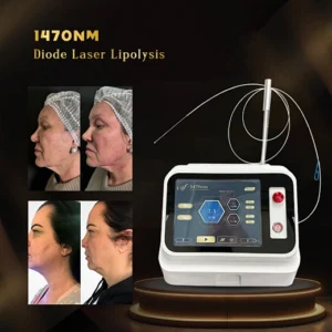 fiber lifting endolaser 980nm 1470nm laser lipolysis endolifting facial tightening machine