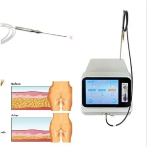 Plastic surgery endolift laser Liposuction power cannula power cannula handle 980nm diode laser liposuction