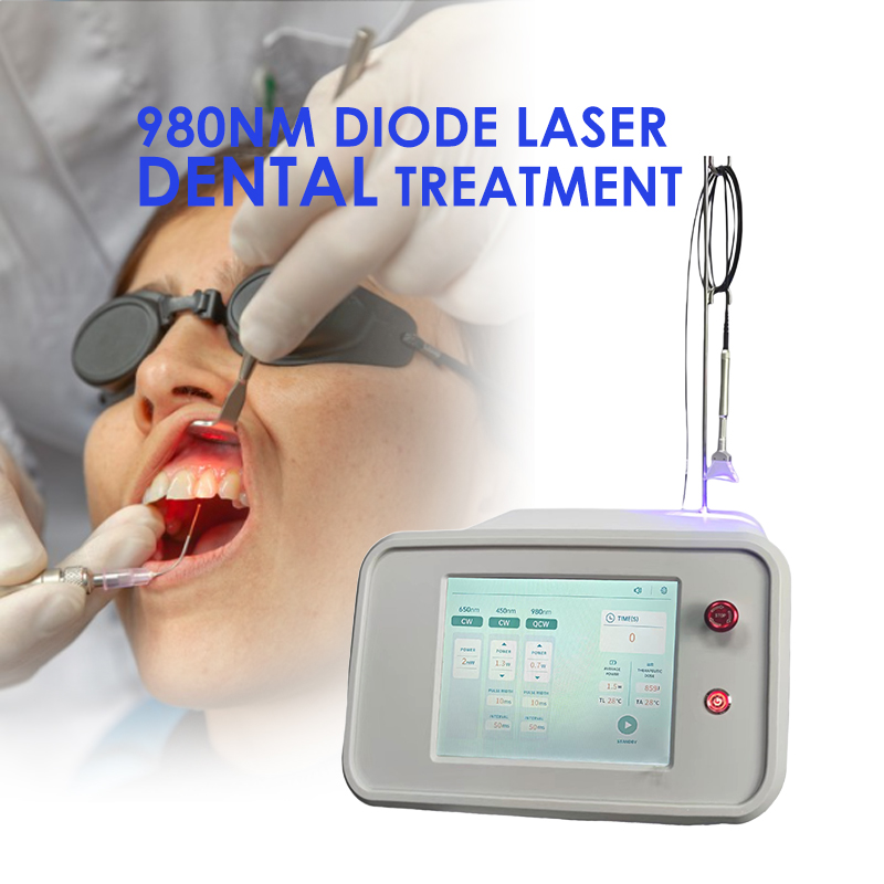 980nm diode laser dental treatment