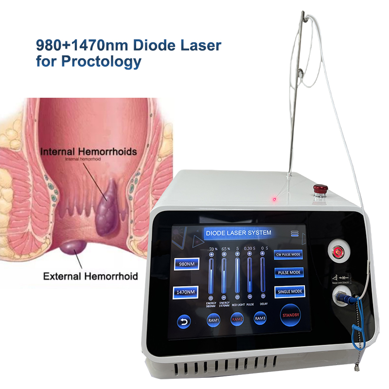 hemorrhoids treatment hemorrhoid laser machine hemorrhoids laser machine